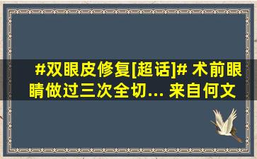 #双眼皮修复[超话]# 术前眼睛做过三次全切... 来自何文星·专注眼...