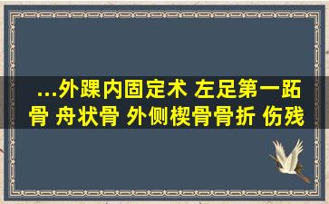 ...外踝内固定术 左足第一跖骨 舟状骨 外侧楔骨骨折 伤残鉴定能定几级