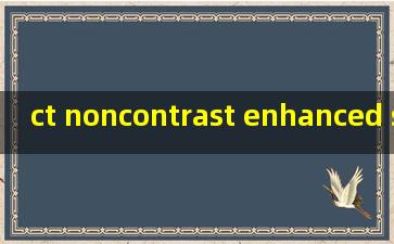 ct noncontrast enhanced scan中文是什么意思