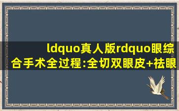 “真人版”眼综合手术全过程:全切双眼皮+祛眼袋,健康养生,健康...