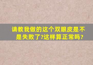 【请教】我做的这个双眼皮是不是失败了?这样算正常吗?