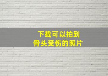 下载可以拍到骨头受伤的照片