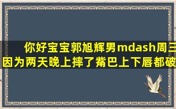 你好,宝宝郭旭辉男—周三,因为两天晚上摔了觜巴上下唇都破了流了很...