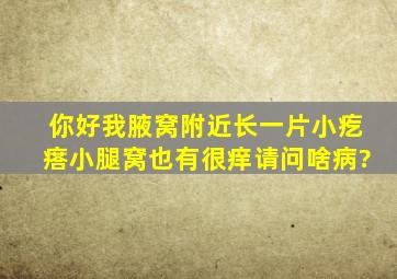 你好我腋窝附近长一片小疙瘩小腿窝也有很痒请问啥病?