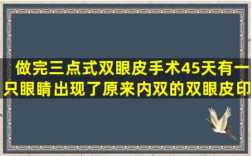 做完三点式双眼皮手术45天有一只眼睛出现了原来内双的双眼皮印 ...