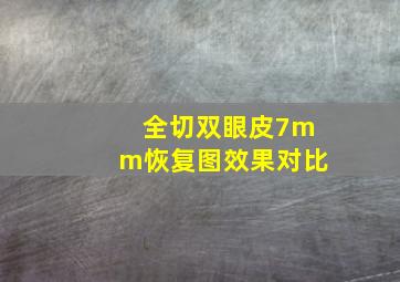 全切双眼皮7mm恢复图效果对比