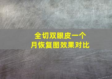 全切双眼皮一个月恢复图效果对比