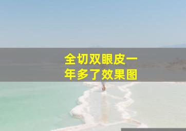 全切双眼皮一年多了效果图