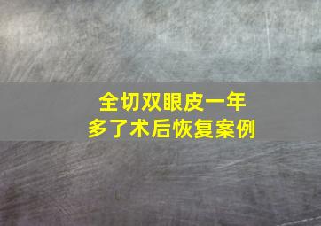 全切双眼皮一年多了术后恢复案例