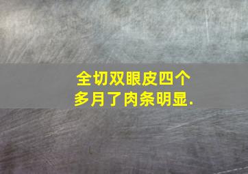 全切双眼皮四个多月了,肉条明显,.