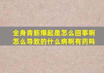 全身青筋爆起是怎么回事啊,怎么导致的,什么病啊,有药吗