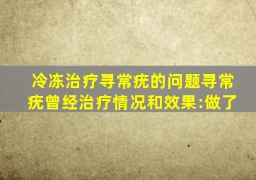 冷冻治疗寻常疣的问题寻常疣曾经治疗情况和效果:做了