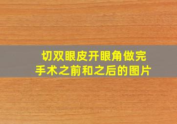 切双眼皮开眼角做完手术之前和之后的图片