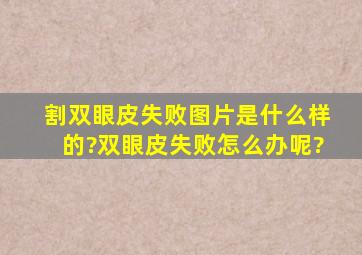 割双眼皮失败图片是什么样的?双眼皮失败怎么办呢?