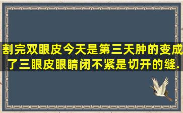 割完双眼皮今天是第三天,肿的,变成了三眼皮,眼睛闭不紧,是切开的,缝...