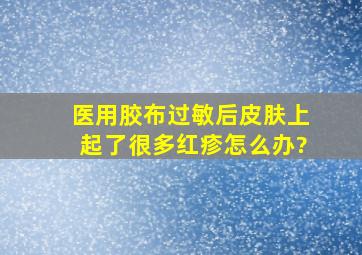 医用胶布过敏后皮肤上起了很多红疹怎么办?