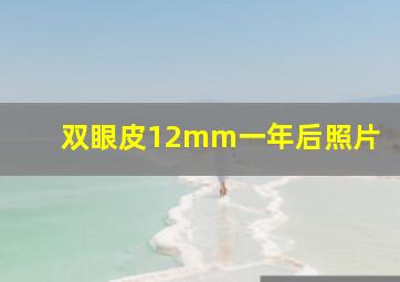 双眼皮12mm一年后照片