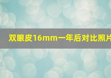 双眼皮16mm一年后对比照片