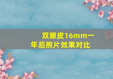 双眼皮16mm一年后照片效果对比