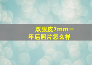 双眼皮7mm一年后照片怎么样