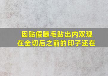 因贴假睫毛贴出内双现在全切后之前的印子还在