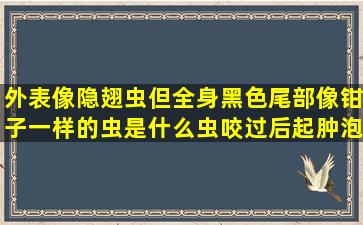 外表像隐翅虫但全身黑色,尾部像钳子一样的虫是什么虫,咬过后起肿泡...