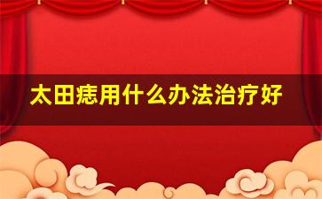 太田痣用什么办法治疗好