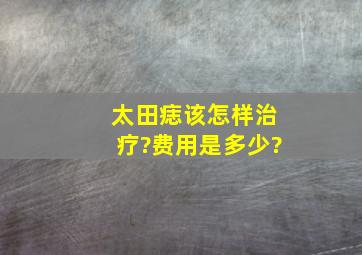 太田痣该怎样治疗?费用是多少?