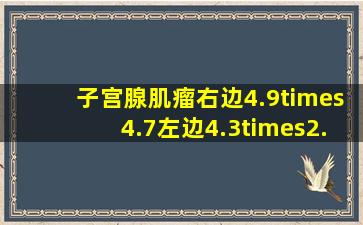 子宫腺肌瘤右边4.9×4.7左边4.3×2.6怎么治疗