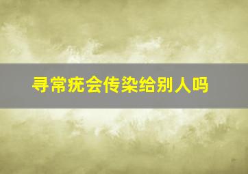 寻常疣会传染给别人吗