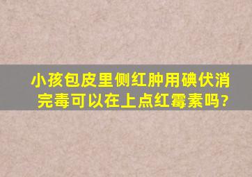 小孩包皮里侧红肿,用碘伏消完毒可以在上点红霉素吗?