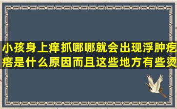 小孩身上痒,抓哪哪就会出现浮肿,疙瘩,是什么原因而且这些地方有些烫