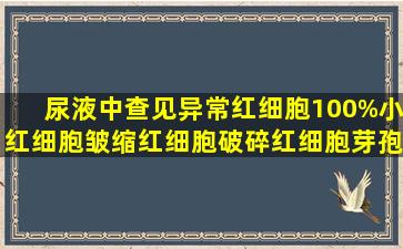 尿液中查见异常红细胞100%,小红细胞,皱缩红细胞,破碎红细胞,芽孢样...