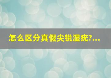 怎么区分真假尖锐湿疣?...