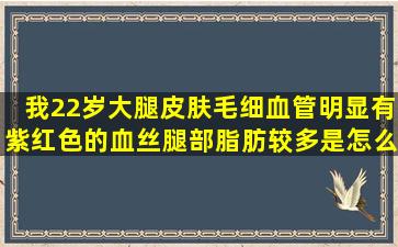 我22岁,大腿皮肤毛细血管明显,有紫红色的血丝,腿部脂肪较多,是怎么回...