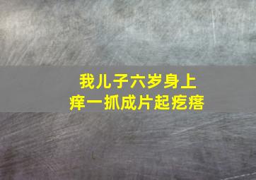 我儿子六岁身上痒一抓成片起疙瘩