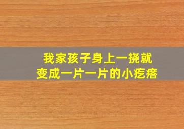 我家孩子身上一挠就变成一片一片的小疙瘩