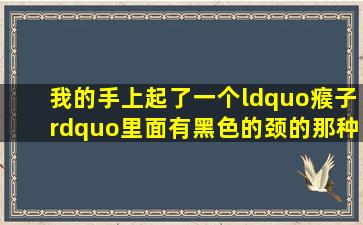 我的手上起了一个“瘊子”里面有黑色的颈的那种,有什么好的办法把...