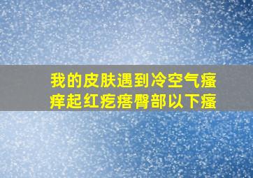 我的皮肤遇到冷空气瘙痒起红疙瘩臀部以下瘙