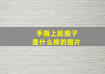 手指上起瘊子是什么样的图片