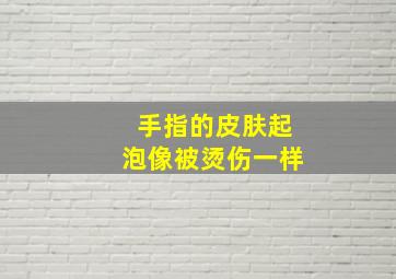 手指的皮肤起泡,像被烫伤一样。