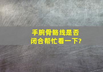 手腕骨骼线是否闭合,帮忙看一下?