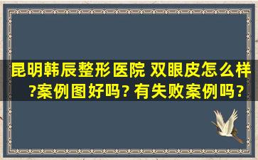 昆明韩辰整形医院 双眼皮怎么样?案例图好吗? 有失败案例吗?