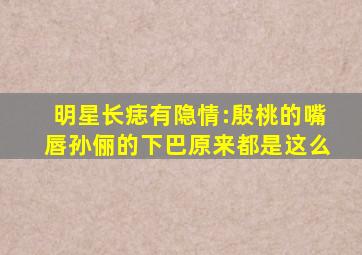 明星长痣有隐情:殷桃的嘴唇,孙俪的下巴原来都是这么