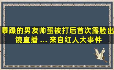 暴躁的男友帅蛋被打后,首次露脸出镜直播 ... 来自红人大事件 