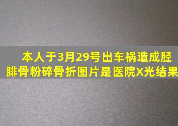 本人于3月29号出车祸造成胫腓骨粉碎骨折图片是医院X光结果。