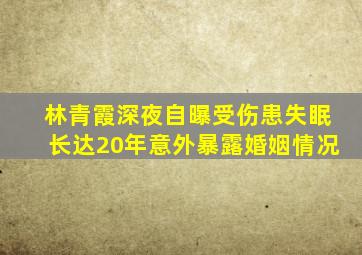 林青霞深夜自曝受伤,患失眠长达20年,意外暴露婚姻情况