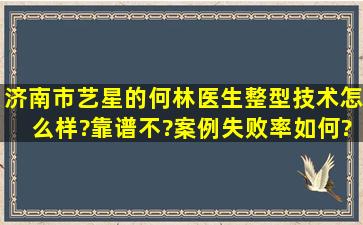 济南市艺星的何林医生整型技术怎么样?靠谱不?案例失败率如何?