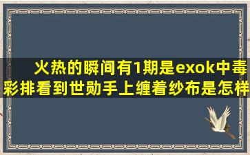 火热的瞬间有1期是exok中毒彩排看到世勋手上缠着纱布是怎样回事