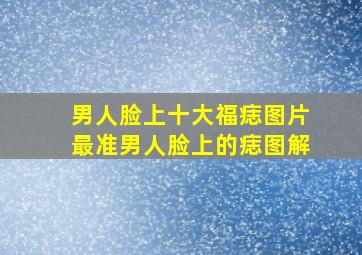 男人脸上十大福痣图片最准男人脸上的痣图解(